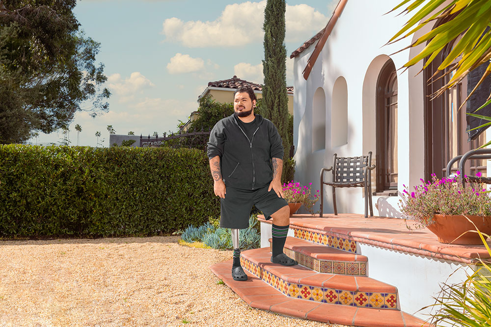 Robert Johnson, an osseointegration recipient for his prosthetic leg, stands on a porch in his Mid-City neighorhood